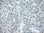 NRBP Antibody in Immunohistochemistry (Paraffin) (IHC (P))