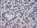 SCYL3 Antibody in Immunohistochemistry (Paraffin) (IHC (P))