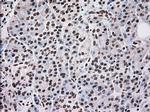 SCYL3 Antibody in Immunohistochemistry (Paraffin) (IHC (P))
