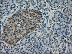 VMAT2 Antibody in Immunohistochemistry (Paraffin) (IHC (P))