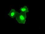 TMEM100 Monoclonal Antibody (OTI10G3)