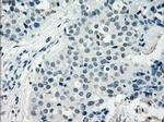 NAT8 Antibody in Immunohistochemistry (Paraffin) (IHC (P))
