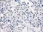 PRKY Antibody in Immunohistochemistry (Paraffin) (IHC (P))