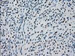 PRKY Antibody in Immunohistochemistry (Paraffin) (IHC (P))