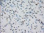 PRKY Antibody in Immunohistochemistry (Paraffin) (IHC (P))