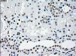 PRKY Antibody in Immunohistochemistry (Paraffin) (IHC (P))