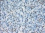 PRKY Antibody in Immunohistochemistry (Paraffin) (IHC (P))