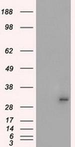 PRKY Antibody in Western Blot (WB)