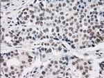PRKY Antibody in Immunohistochemistry (Paraffin) (IHC (P))