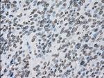 PRKY Antibody in Immunohistochemistry (Paraffin) (IHC (P))