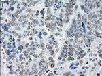 PRKY Antibody in Immunohistochemistry (Paraffin) (IHC (P))
