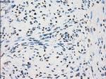 PRKY Antibody in Immunohistochemistry (Paraffin) (IHC (P))