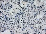 PRKY Antibody in Immunohistochemistry (Paraffin) (IHC (P))