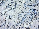 PRKY Antibody in Immunohistochemistry (Paraffin) (IHC (P))