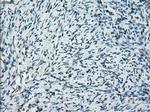 PRKY Antibody in Immunohistochemistry (Paraffin) (IHC (P))