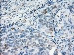 PRKY Antibody in Immunohistochemistry (Paraffin) (IHC (P))
