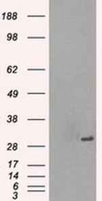 PRKY Antibody in Western Blot (WB)