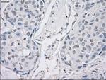 PP5 Antibody in Immunohistochemistry (Paraffin) (IHC (P))