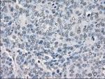 PP5 Antibody in Immunohistochemistry (Paraffin) (IHC (P))