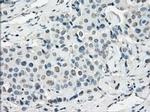 SSX2 Antibody in Immunohistochemistry (Paraffin) (IHC (P))