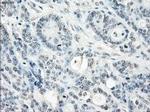 SSX2 Antibody in Immunohistochemistry (Paraffin) (IHC (P))