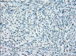 SSX2 Antibody in Immunohistochemistry (Paraffin) (IHC (P))