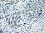SSX2 Antibody in Immunohistochemistry (Paraffin) (IHC (P))