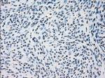 SSX2 Antibody in Immunohistochemistry (Paraffin) (IHC (P))