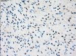 SSX2 Antibody in Immunohistochemistry (Paraffin) (IHC (P))