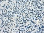 SSX2 Antibody in Immunohistochemistry (Paraffin) (IHC (P))
