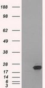 SSX2 Antibody in Western Blot (WB)