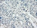 SSX2 Antibody in Immunohistochemistry (Paraffin) (IHC (P))