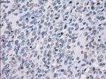 SSX2 Antibody in Immunohistochemistry (Paraffin) (IHC (P))