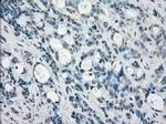 SSX2 Antibody in Immunohistochemistry (Paraffin) (IHC (P))