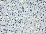 SSX2 Antibody in Immunohistochemistry (Paraffin) (IHC (P))