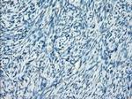 SSX2 Antibody in Immunohistochemistry (Paraffin) (IHC (P))