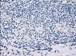 SSX2 Antibody in Immunohistochemistry (Paraffin) (IHC (P))