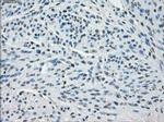 SSX2 Antibody in Immunohistochemistry (Paraffin) (IHC (P))