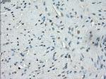 SSX2 Antibody in Immunohistochemistry (Paraffin) (IHC (P))