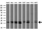 SSX2 Antibody in Western Blot (WB)