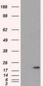 SSX2 Antibody in Western Blot (WB)