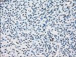 ZFP36 Antibody in Immunohistochemistry (Paraffin) (IHC (P))