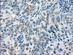 GBP2 Antibody in Immunohistochemistry (Paraffin) (IHC (P))