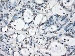 XRCC4 Antibody in Immunohistochemistry (Paraffin) (IHC (P))