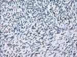 XRCC4 Antibody in Immunohistochemistry (Paraffin) (IHC (P))