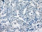 XRCC4 Antibody in Immunohistochemistry (Paraffin) (IHC (P))