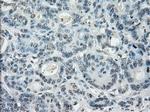 LTA4H Antibody in Immunohistochemistry (Paraffin) (IHC (P))