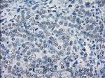 LTA4H Antibody in Immunohistochemistry (Paraffin) (IHC (P))