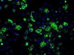 Fumarase Antibody in Immunocytochemistry (ICC/IF)