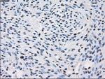 Fumarase Antibody in Immunohistochemistry (Paraffin) (IHC (P))